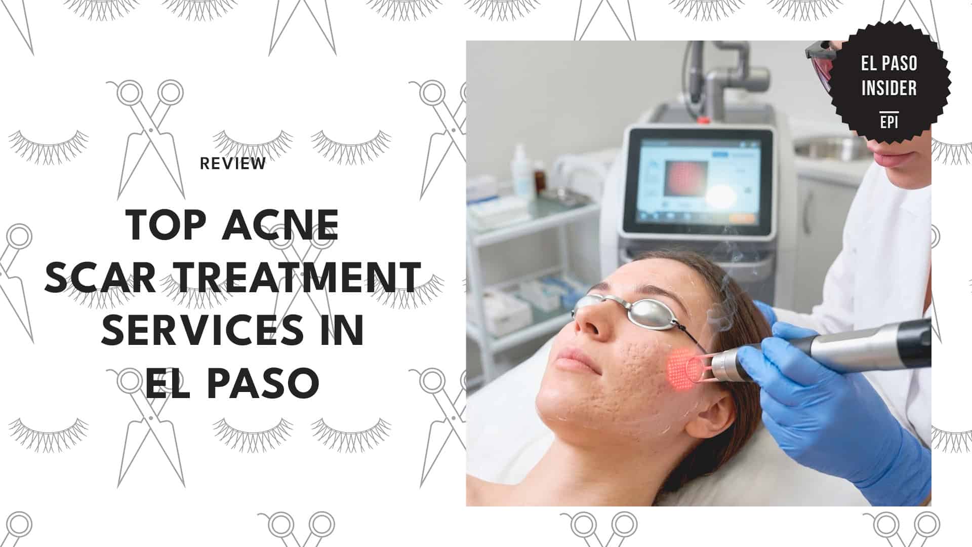 acne-scar-treatment-in-el-paso