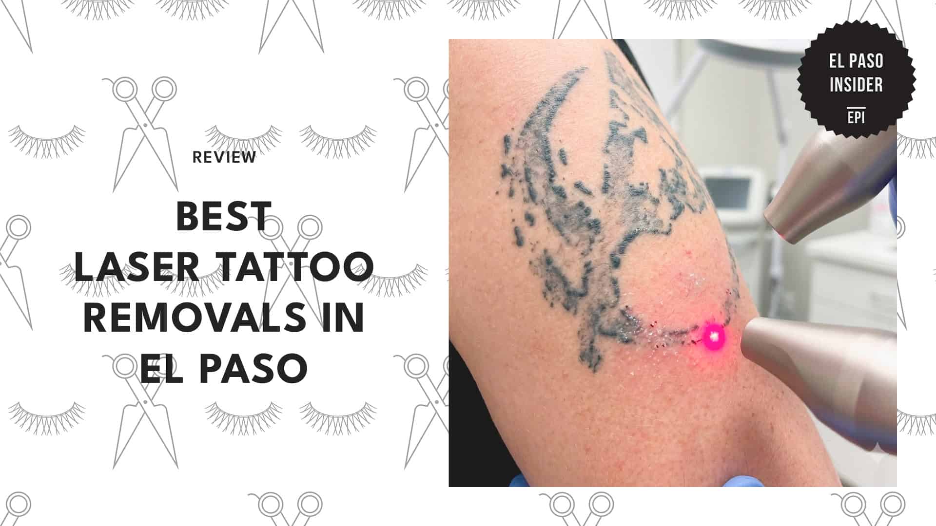 tattoo-removal-shops-in-el-paso